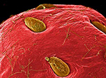 Imagen al microscopio electrónico de una fresa